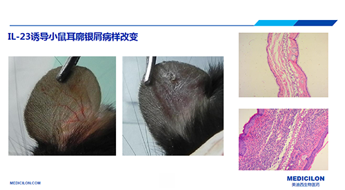 白介素IL-23誘導(dǎo)的小鼠耳廓銀屑病樣改變