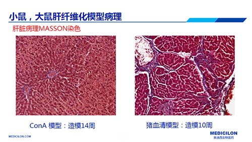 ConA和豬血清誘導(dǎo)的肝纖維化模型