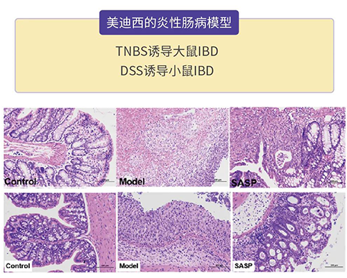 美迪西的炎癥性腸病模型