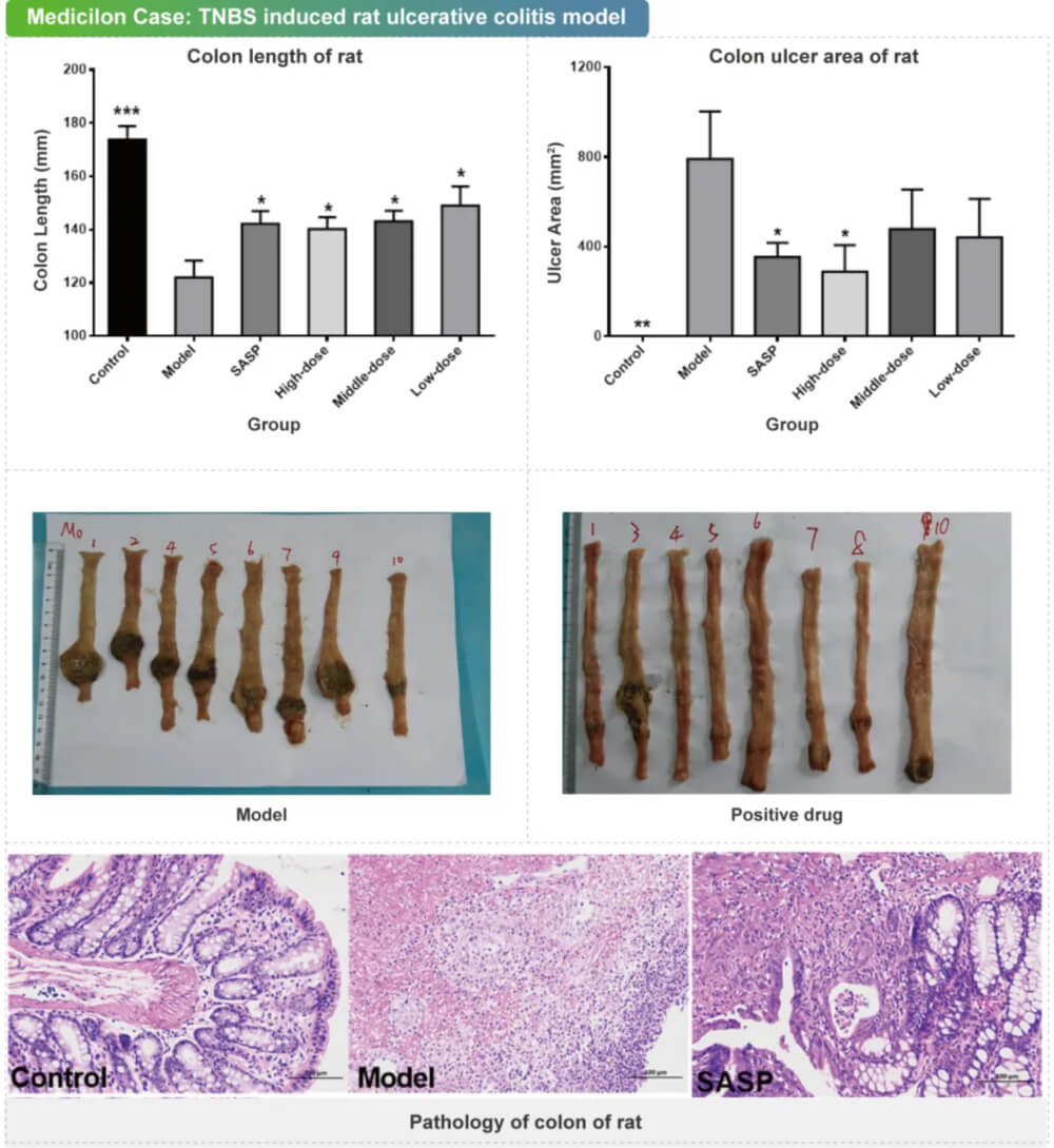 10 TNBS誘導的大鼠潰瘍性結(jié)腸炎模型.jpg